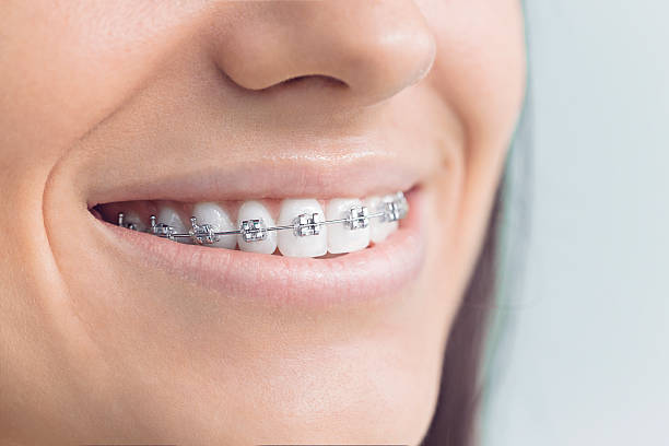 Best Traditional Braces  in Oologah, OK
